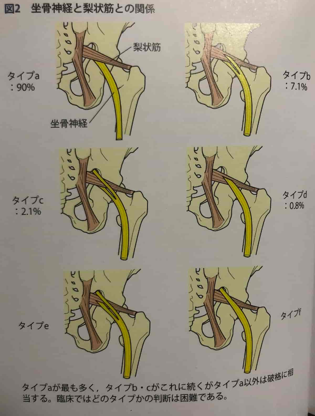 坐骨神経と梨状筋の解剖